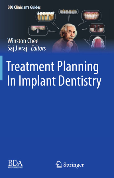 Treatment Planning In Implant Dentistry, 2nd Edition