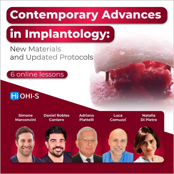 Contemporary Advances in Implantology: New Materials and Updated Protocols