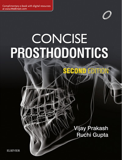 Concise Prosthodontics, 2nd Edition