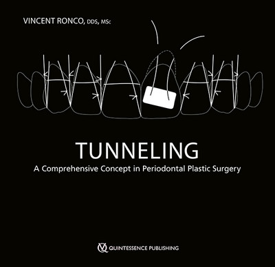 Tunneling: A Comprehensive Concept in Periodontal Plastic Surgery (Scanned Copy)