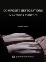 Esthetic Anterior Composite Restorations (Scanned PDF Copy)