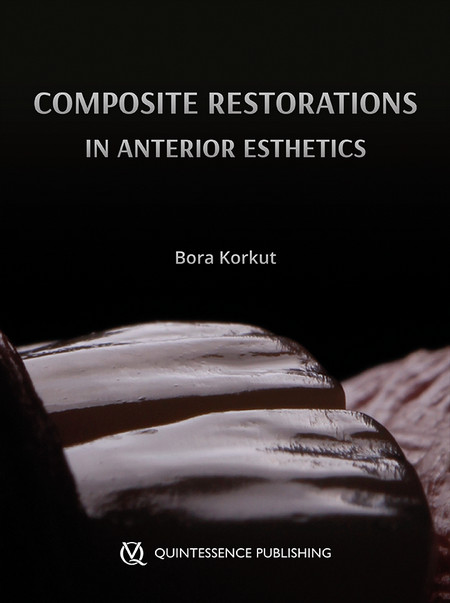 Esthetic Anterior Composite Restorations (Scanned PDF Copy) Esthetic Anterior Composite Restorations (Scanned PDF Copy)