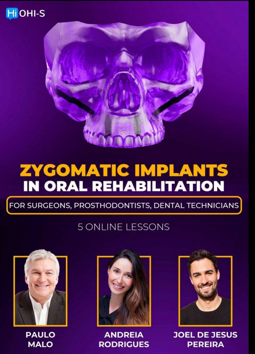 Zygomatic Implants in Oral Rehabilitation: For surgeons, prosthodontists, dental technicians