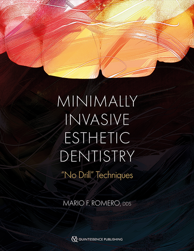 Minimally Invasive Esthetic Dentistry: “No Drill” Techniques