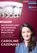 Microimplant Anchorage in Clinical Practice: Guide for Beginners and Intermediate