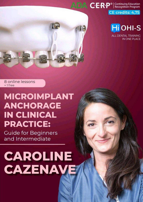 Microimplant Anchorage in Clinical Practice: Guide for Beginners and Intermediate Microimplant Anchorage in Clinical Practice: Guide for Beginners and Intermediate