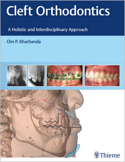 Cleft Orthodontics: A Holistic and Interdisciplinary Approach