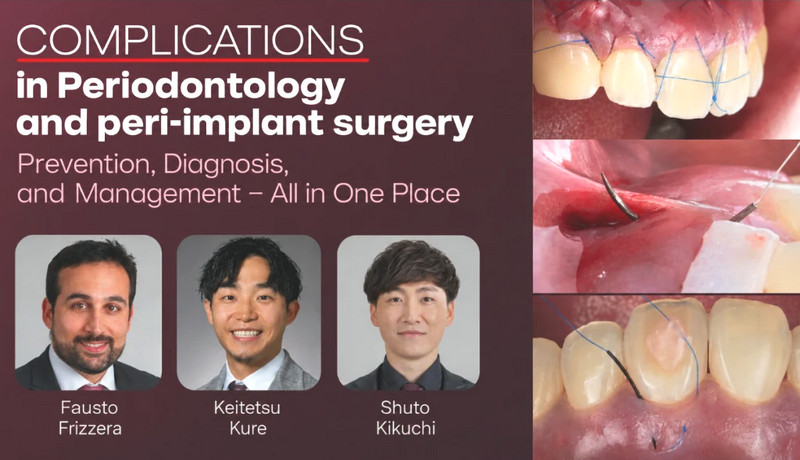 Complications in Periodontology and Peri-implant Surgery Prevention, Diagnosis, and Management – All in One Place
