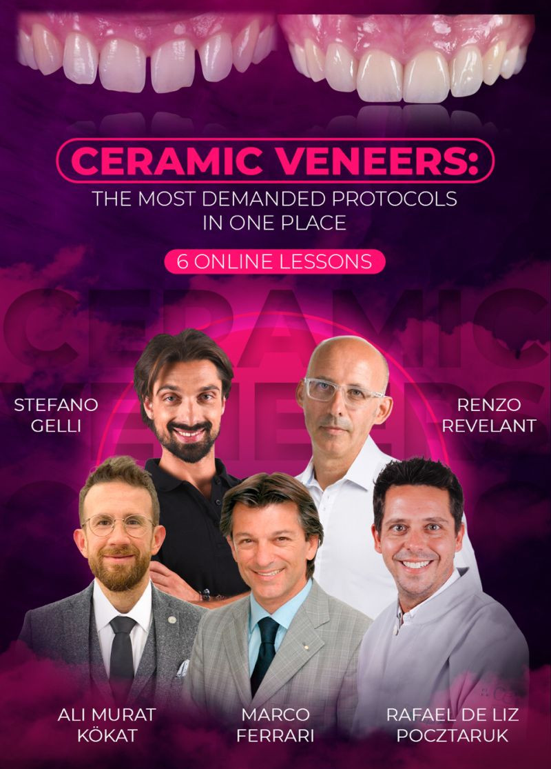 Ceramic Veneers: the Most Demanded Protocols in one Place