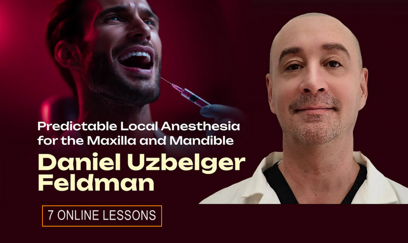 Predictable Local Anesthesia for the Maxilla and Mandible